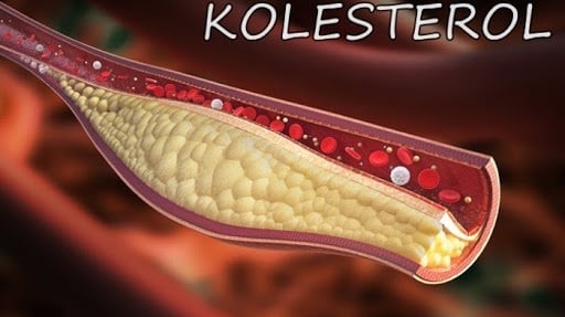 Cara Menurunkan Kolesterol Alami